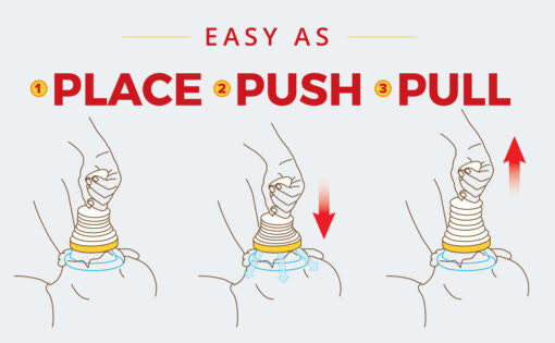 How Do Anti-Choking Devices Work to Save Lives?